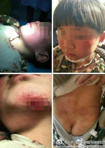 山东临沂8岁男孩被指遭养母虐待 警方介入调查(图) - 半岛网