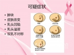 烟台一女子患篮球大小乳房肿瘤 成近年来最大病例 - 东营网